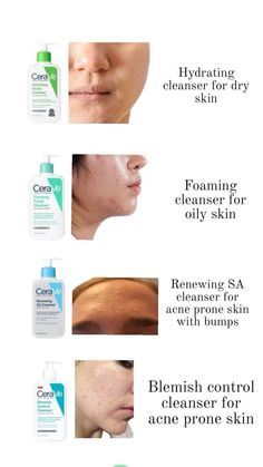 Haut Routine, Face Skin Care Routine, Cleanser For Oily Skin, Natural Face Skin Care, Basic Skin Care Routine, Facial Skin Care Routine, Skin Care Remedies