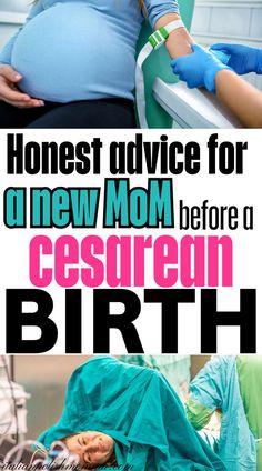 A pregnant woman getting tips and advice on her scheduled c-section and another woman during a cesarean section delivery. C Section Recovery Timeline, New Mom Advice, Scheduled C Section, C Section Scars