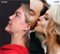 before and after images of a woman kissing a man's forehead with her eyes closed