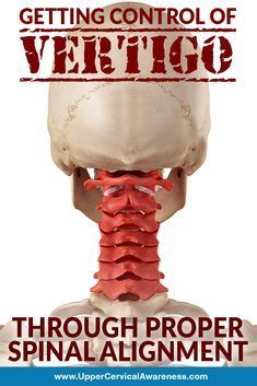 A study observed 60 patients who suffered from chronic vertigoThey all recalled having previous trauma to their upper cervical area. Vestibular Migraines, Upper Cervical Chiropractic