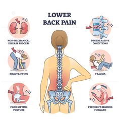 Lower back pain and painful body backbone skeleton causes outline diagram. Labeled educational scheme with explanation of medical condition after disease process or sitting posture vector illustration #Lower #back #pain #spine #backache #commercial #vector #illustration → Get this Illustration for Commercial Use! Lower Back Pain Poster, Low Back Pain Poster, Low Back Pain Exercise, Backbone Anatomy, Spine Illustration, Physio Therapy, Lower Back Pain Causes, Therapy Exercises, Middle Back Pain