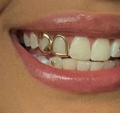 a woman's smile with two gold rings on her teeth