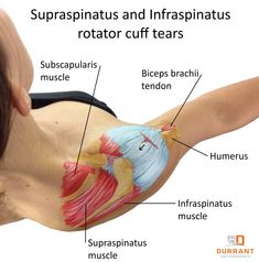 Biceps Brachii Muscle, Subscapularis Muscle, Infraspinatus Muscle, Rotator Cuff Pain, Punkty Spustowe, Shoulder Rehab Exercises, Shoulder Anatomy, Rotator Cuff Exercises, Rotator Cuff Surgery