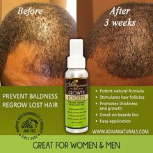 Hair Regrowth For Men, Regrow Lost Hair, Hair Regrowth Women, Natural Hair Regrowth, Hair Growth Secrets, Rapunzel Hair, Hair Regrowth Treatments, Bathroom Gadgets, Princess Hair