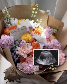 a bouquet of flowers is shown with an x - ray image in the center and a card for someone's birth