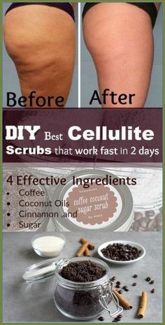 Coffee Ingredients, Health Tips For Women, Scrub Recipe, Body Scrubs, Homemade Beauty Products, Health And Beauty Tips, Health Remedies, Healthy Tips, Diy Beauty