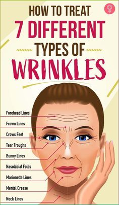 Wrinkles Remedies Face, Wrinkle Free Skin, Forehead Wrinkles, Skin Care Wrinkles, Baking Soda Shampoo, Face Wrinkles, Eye Wrinkle, Deep Skin