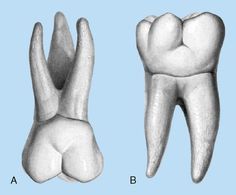 Visit the post for more. Molar Tooth Drawing, Tooth Drawing, Teeth Anatomy, Dental Health Care, Molar Tooth