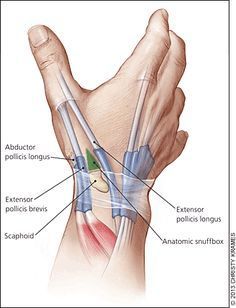 Evaluation and Diagnosis of Wrist Pain: A Case-Based Approach - American Family Physician Family Physician, Hand Anatomy, Wrist Pain, Human Body Anatomy, Medical School Studying