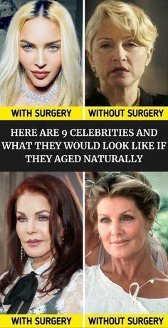 Elvis Impersonator, Old Celebrities, Celebrities Before And After, Hairstyle Women