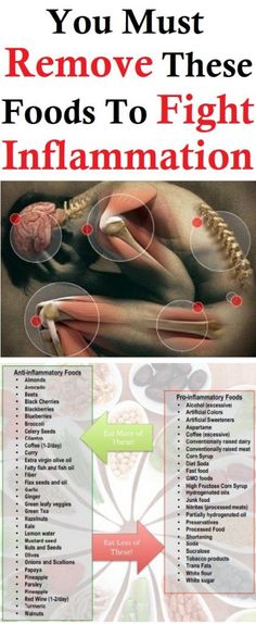 Knowing your body Anti Dieting, Anti Inflammation, Inflammatory Foods, Alternative Treatments, Holistic Health, Health And Nutrition