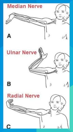 Punkty Spustowe, Ulnar Nerve, Median Nerve, Acupressure Mat, Yoga Iyengar, Medical Anatomy, Hand Therapy, Optimal Health