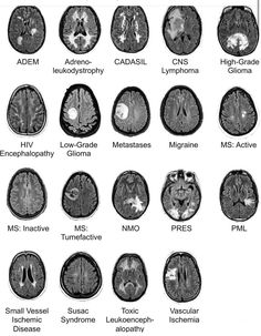 the different areas of the brain are labeled in black and white