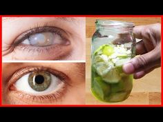 Strengthen Eyesight, Stye Remedy, Eye Health Facts, Eyesight Problems, Big Stomach, Eyeglass Cleaner, Wear Rings