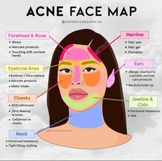 Face Map, Face Mapping Acne, Face Mapping, Good Skin Tips, Basic Skin Care Routine, Clear Skin Tips, Perfect Skin Care Routine, Healthy Skin Tips, Facial Skin Care Routine