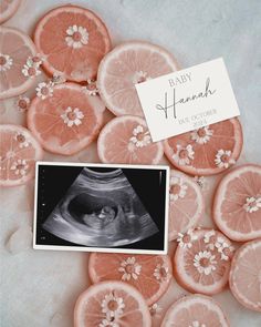 an x - ray image is surrounded by sliced oranges