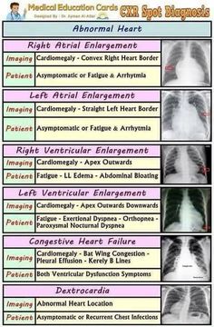 the chest and chest are labeled with different types of ribrings, which can be used