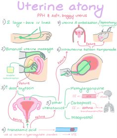 the diagram shows different types of uterines and how they are used to treat them