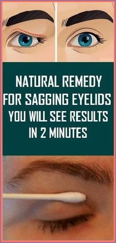 Natural Remedy For Sagging Eyelids You Will See Results In 2 Minutes Upper Eyelid, Women's Beauty, Lifestyle Habits, Natural Remedy, Diy Health, Natural Medicine