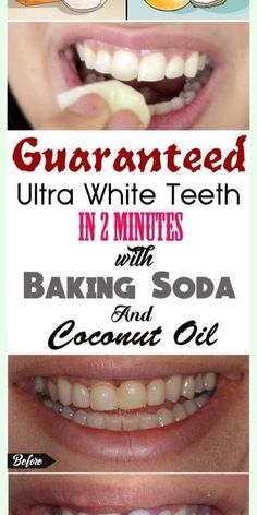 Must try this hack for teeth whitening within 2 minutes For White Teeth, Health Coconut Oil, Healthy Recipes Clean Eating, Motivational Fitness Quotes, Healthy Recipes Clean, Yellow Teeth, Coconut Oil Uses, Recipes Clean Eating