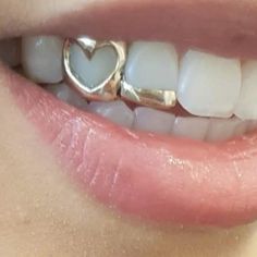 a close up of a person's teeth with a heart ring on top of it