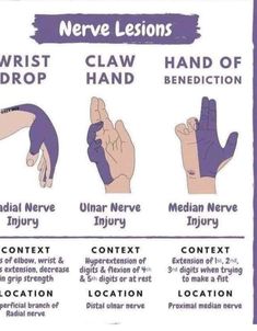 Carpal Tunnel Relief, Radial Nerve, Human Muscle Anatomy, Ulnar Nerve, Median Nerve, Mid Term, Electronic Paper, Heart Anatomy