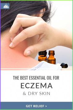 Tired of dealing with dry, itchy skin from eczema? In this article, we share the best essential oil for eczema including 7 others to calm and soothe angry skin. Home Remedies For Skin, Skin Condition, Skin Remedies, Best Essential Oils, Essential Oil Uses, Itchy Skin, Oils For Skin, Young Living, Essential Oil Blends