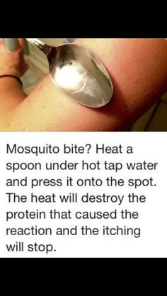 Remedies For Mosquito Bites, Sick Remedies, Mosquito Bites, Survival Skills Life Hacks, Survival Life Hacks, Mosquito Bite, Survival Life, Eucalyptus Oil