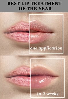 Lip Tricks, Plump Lips Naturally, Almond Eye Makeup, City Lips, Sunless Tanning Lotion, Makeup For Older Women, Makeup Secret, Plump Lips, Mommy Quotes