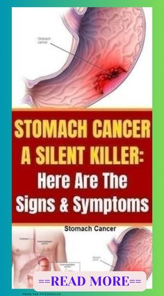 Stomach Virus, Silent Killer, Health Signs, Daily Health Tips, Healthy Beauty, As It Was, Health Articles, Signs And Symptoms, Health Facts