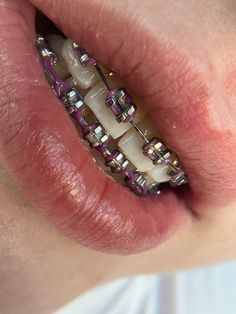 Perfect Teeth Braces, Pink Braces, Green Braces, Jewelry Teeth, Braces Colors Ideas, Teeth Gems, Delicious Healthy Food, Cute Braces Colors, Teeth Aesthetic