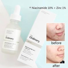 Niacinamide The Ordinary, The Ordinary Niacinamide 10% + Zinc 1%, The Ordinary Vitamin C Suspension, The Ordinary Skincare Retinol 1%, The Ordinary Niacinamide 10% + Zinc 1% Skincare, The Ordinary Zinc 1%, The Ordinary Hyaluronic Acid 2% + B5, Ordinary Retinoid 2%, The Ordinary Serum