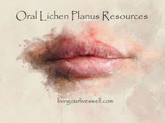 Tongue Problems, Burning Mouth, Nerve Anatomy, Autoimmune Disorders, Sjogrens Syndrome, Medicinal Herbs Garden, Canker Sore