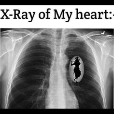 an x - ray image with the words x - ray of my heart