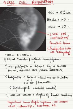 a piece of paper with writing on it and an image of the eye in red