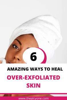 Signs of over-exfoliation include dry skin, flakey and rough skin, redness, itchiness, your skin is shinier than normal and your skin is irritated and hypersensitive. Ways To Heal, Rough Skin, Glowing Complexion, Daily Skin Care Routine, Signs And Symptoms, Skincare Tips, The Signs, Radiant Skin