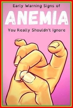 Early Warning Signs of ANEMIA You Really Shouldn’t Ignore Nails Remedies, Health Articles Wellness, Natural Health Remedies, Warning Signs