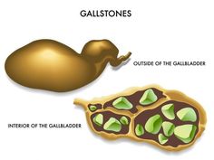 Quadrants Of The Abdomen, Herbal Vitamins, Mthfr Gene Mutation