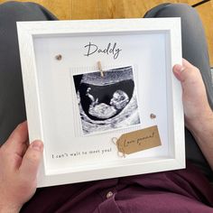 Baby Scan Photo Frame Baby Scan Photos, Selling Crafts, Baby Announcement Pictures, Cute Pregnancy Announcement, Baby Scan, Baby Art Projects, Coloring Calendar, Shower Bebe