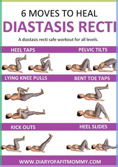 the 6 moves to heal diastasis recti