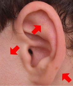 Ear Infection: Apply a drop each of Lavender and Melaleuca and at any (or all) of the three points in the picture (behind, on, and/or in front of ear). Rub in and your done. This takes one treatment, unless it is a monster ear infection (like an antibiotic resistant one). If it's a serious infection, apply every 3-4 hours for a day and that should clear it up. Essential Oil Remedy, Yl Oils, Oil Remedies, Essential Oils Health, Yl Essential Oils, E Mc2, Doterra Oils, Oil Uses