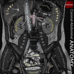 an x - ray shows the location of the brain and its surrounding areas, with words written all over it