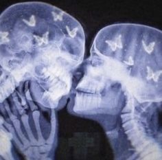 x - ray image of two people kissing each other with butterflies on their heads and shoulders