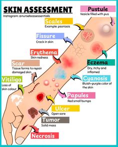 an arm with different types of skin on it and the names of its functions in each section