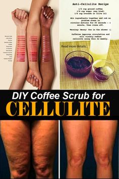 Exercises to Get Rid of Cellulite on Thighs - What Works and What Doesn't - When looking for exercises to get rid of cellulite on thighs, one of the hardest things to deal with is trying to find... Liquid Chlorophyll Benefits, Coffee Sugar Scrub, Coffee Scrub Diy, Baking Soda Bath, Natural Mouthwash, Clean Scalp, Scalp Scrub, Hormonal Acne, Natural Health Remedies