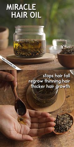 Miracle Hair Growth, Hair Growth Oil Recipe, Regrow Thinning Hair, Diy Hair Oil, Grow Thicker Hair, Thick Hair Growth, Healthy Natural Hair Growth, Hair Growth Diy, Hair Remedies For Growth Miracle Hair Growth, Hair Growth Oil Recipe, Regrow Thinning Hair, Diy Hair Oil, Grow Thicker Hair, Thick Hair Growth, Hair Growth Secrets, Hair Remedies For Growth