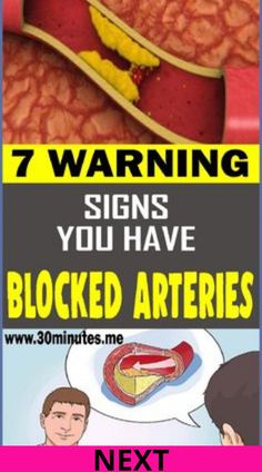 Clogged Arteries, Medical Problems, Millionaire Lifestyle, Warning Signs, Health Diet, Alternative Medicine, Health Remedies, Diet And Nutrition