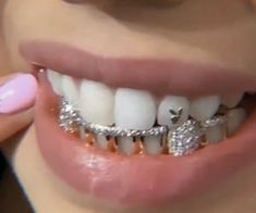 a close up of a person with braces on their teeth and pink nail polish