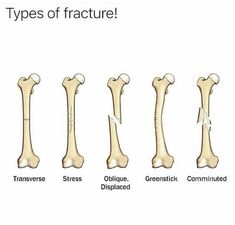 different types of bones are shown in this diagram, including the lower limbs and upper limbs