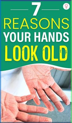 7 Reasons Your Hands Look Old: Here are 7 things that give your hands an aged appearance and what you can do to fix them. #hands #aging #skinca Wrinkles Hands, Face Pores, Healthy Recipes For Diabetics, Health Podcast, Blood Sugar Diet, Healthy Blood Sugar Levels, Skin Products